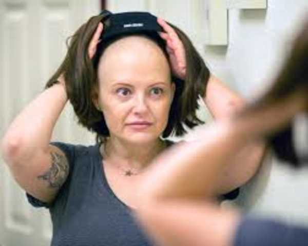 Как восстановить волосы после борьбы с раком