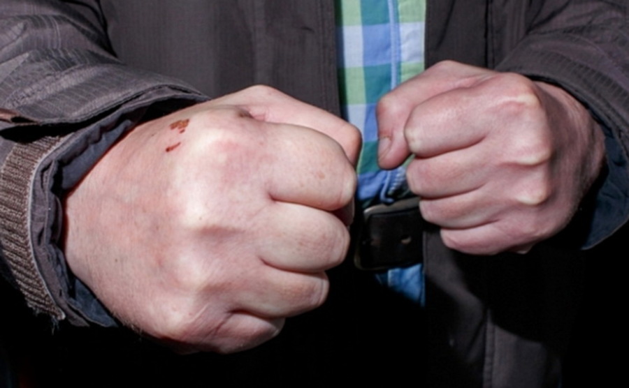 В Клинцах пьяный мужчина ударил разозлившего его полицейского 