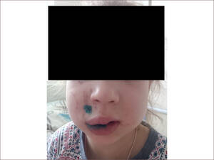 «Хотят спустить на тормоза!»: в Брянске пытаются замять ЧП у кафе «Итальянцы»