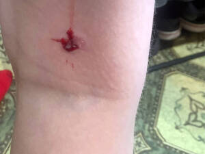 Бастрыкин поручил брянскому СК возбудить дело о нападении собаки на ребенка