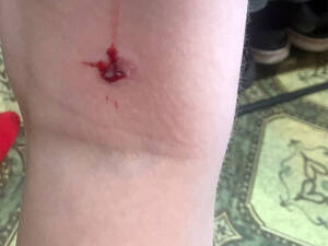 В Сосновом бору в Брянске собака укусила ребенка