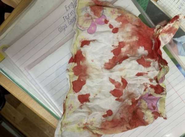 В Оренбурге школьница порезалась о стекло, попавшее в пирожок с брянским джемом