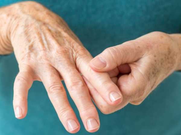 Ревматоидный артрит: основные причины, общие симптомы и лечение 