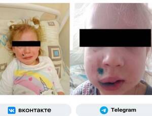 В Брянске с хозяйки кане-корсо требует полмиллиона за укус 4-летней девочки