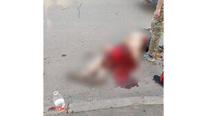 Богомаз: скончался мужчина, пострадавший от обстрела 