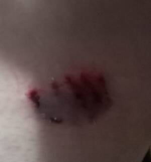 В центре Карачева агрессивная собака напала на женщину