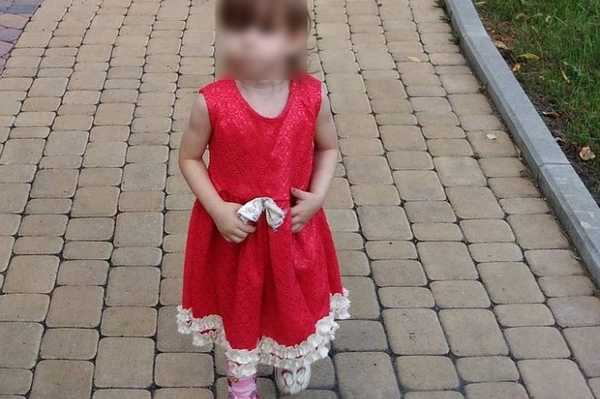 Пострадавшая от поджога платья девочка в Новокузнецке остается в тяжелом состоянии