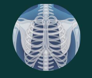 Искусственный интеллект стал помощником брянских врачей-рентгенологов